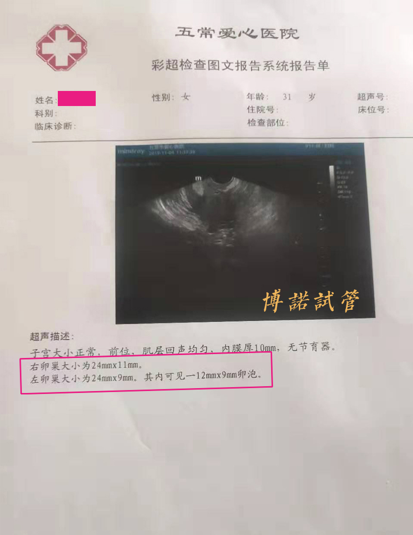 中国借卵流程.jpg