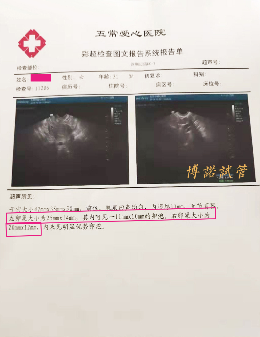 中国借卵妈妈.jpg