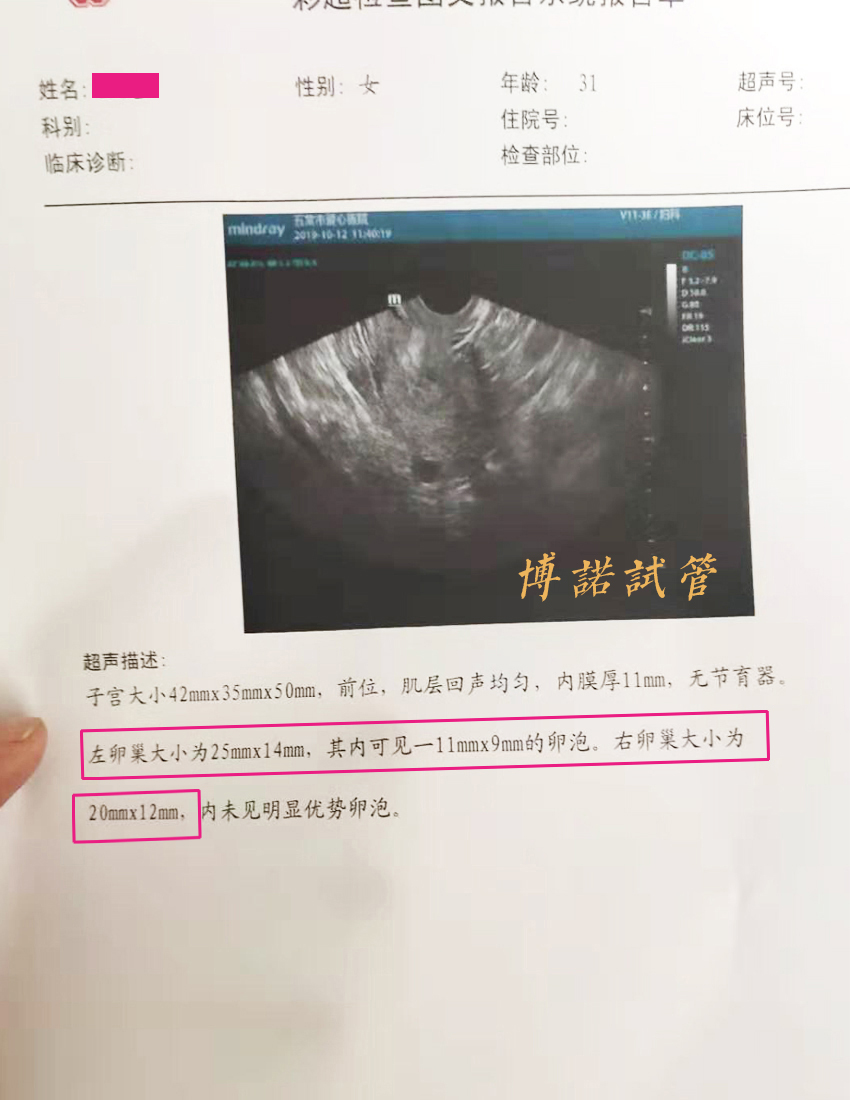 中国借卵中介.jpg