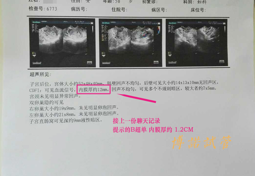 中国借卵价格.jpg