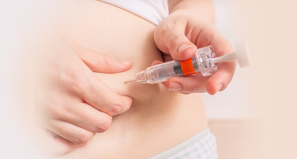 中国代孕机构：试管婴儿移植后做好 11 点 提高着床率